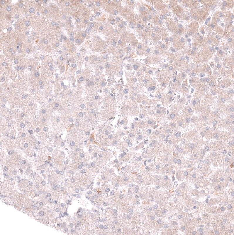 CD27/TNFRSF7 Antibody (CL15464) [Unconjugated] Immunohistochemistry-Paraffin: CD27/TNFRSF7 Antibody (CL15464) [NBP3-43671]