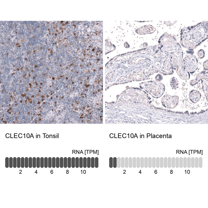 CLEC10A/CD301 Antibody (CL15513) [Unconjugated] Immunohistochemistry-Paraffin: CLEC10A/CD301 Antibody (CL15513) [NBP3-43672]