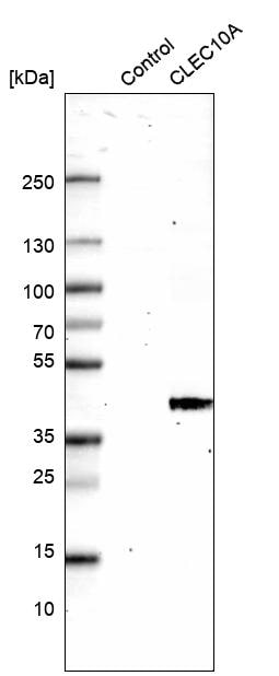 CLEC10A/CD301 Antibody (CL15513) [Unconjugated] Western blot: CLEC10A/CD301 Antibody (CL15513) [NBP3-43672]