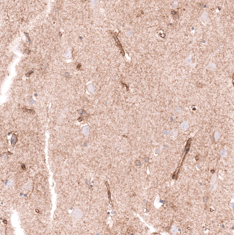 CLEC10A/CD301 Antibody (CL15513) [Unconjugated] Immunohistochemistry-Paraffin: CLEC10A/CD301 Antibody (CL15513) [NBP3-43672]