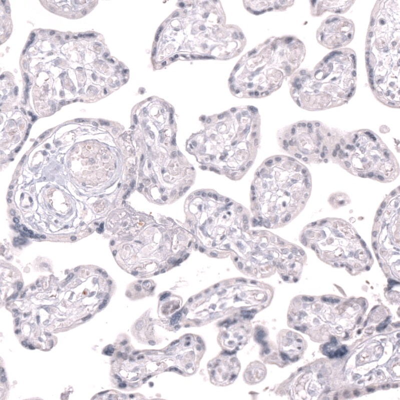 CLEC10A/CD301 Antibody (CL15523) [Unconjugated] Immunohistochemistry-Paraffin: CLEC10A/CD301 Antibody (CL15523) [NBP3-43673]