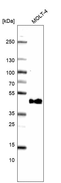 CD38 Antibody (CL15572) [Unconjugated] Western blot: CD38 Antibody (CL15572) [NBP3-43674]