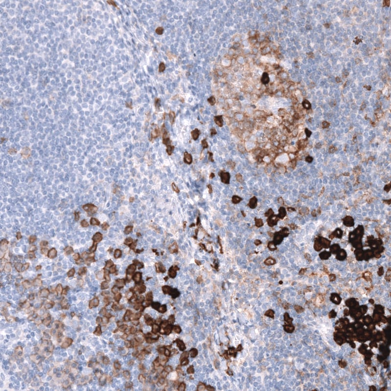 CD38 Antibody (CL15572) [Unconjugated] Immunohistochemistry-Paraffin: CD38 Antibody (CL15572) [NBP3-43674]