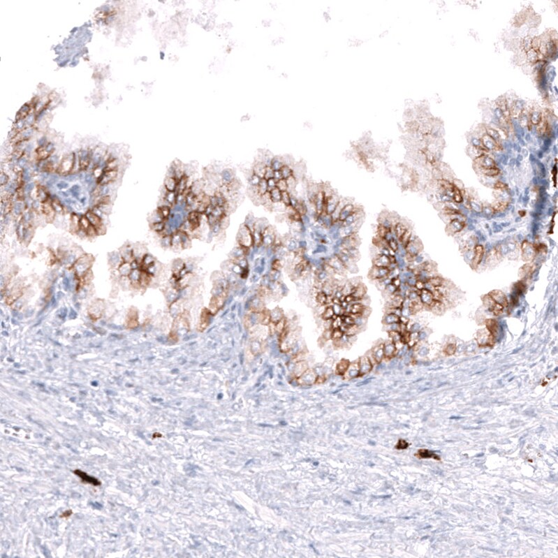 CD38 Antibody (CL15572) [Unconjugated] Immunohistochemistry-Paraffin: CD38 Antibody (CL15572) [NBP3-43674]