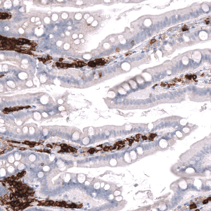 CD38 Antibody (CL15572) [Unconjugated] Immunohistochemistry-Paraffin: CD38 Antibody (CL15572) [NBP3-43674]