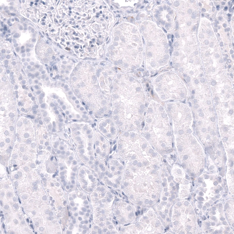CD38 Antibody (CL15572) [Unconjugated] Immunohistochemistry-Paraffin: CD38 Antibody (CL15572) [NBP3-43674]