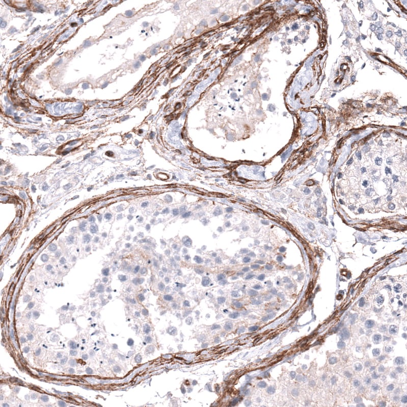 Integrin beta 1/CD29 Antibody (CL15606) [Unconjugated] Immunohistochemistry-Paraffin: Integrin beta 1/CD29 Antibody (CL15606) [NBP3-43675]