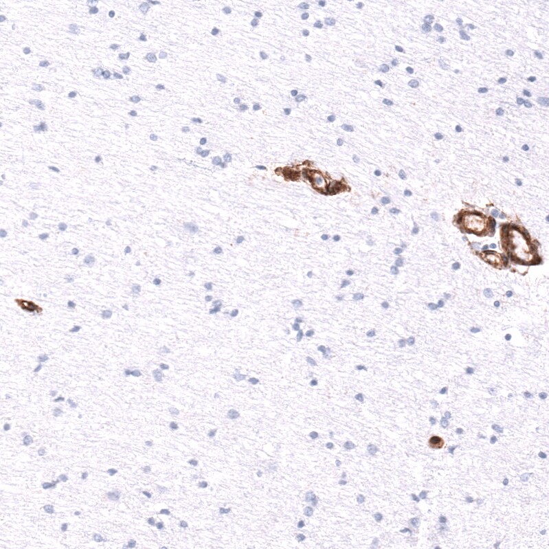 Integrin beta 1/CD29 Antibody (CL15606) [Unconjugated] Immunohistochemistry-Paraffin: Integrin beta 1/CD29 Antibody (CL15606) [NBP3-43675]
