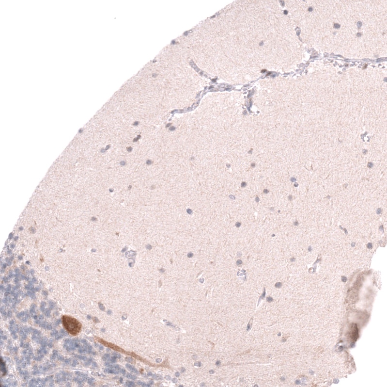 Pleiotrophin/PTN Antibody (CL15628) [Unconjugated] Immunohistochemistry-Paraffin: Pleiotrophin/PTN Antibody (CL15628) [NBP3-43677]