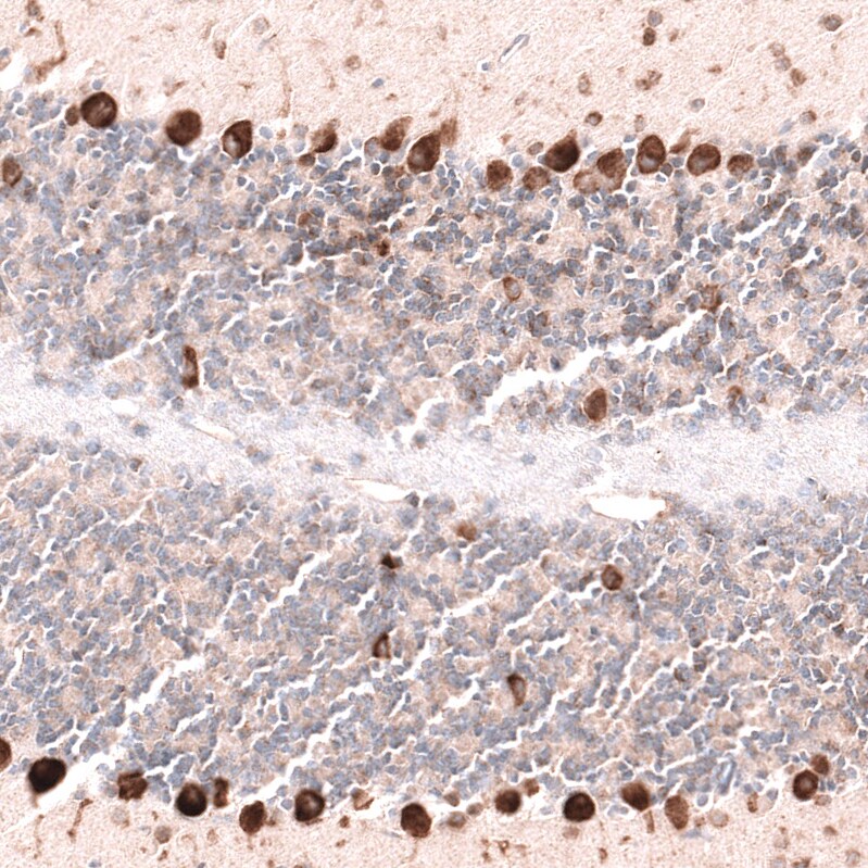 Pleiotrophin/PTN Antibody (CL15628) [Unconjugated] Immunohistochemistry-Paraffin: Pleiotrophin/PTN Antibody (CL15628) [NBP3-43677]
