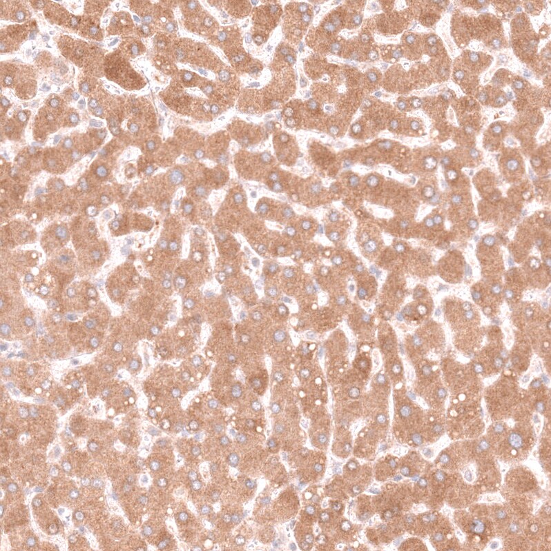 Pleiotrophin/PTN Antibody (CL15628) [Unconjugated] Immunohistochemistry-Paraffin: Pleiotrophin/PTN Antibody (CL15628) [NBP3-43677]