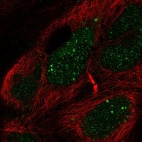 EBF-2 Antibody [Unconjugated] Immunocytochemistry/ Immunofluorescence : EBF-2 pAb [NBP3-43679]
