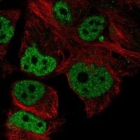 COM1/p8 Antibody - BSA Free Immunocytochemistry/ Immunofluorescence: COM1/p8 Antibody - BSA Free [NBP3-43682]