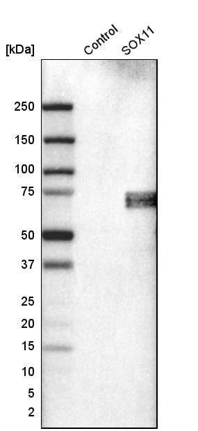 SOX11 Antibody (CL0142) - Azide and BSA Free Western Blot: SOX11 Antibody [NBP3-43690]