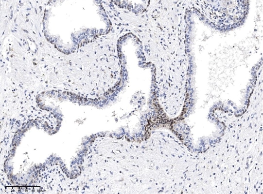 Rabbit anti-Mouse IgG1 Secondary Antibody (20)