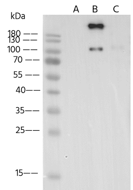 VZV Glycoprotein B Antibody - (Oka vaccine) - Azide and BSA Free