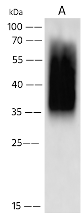 Metapneumovirus Glycoprotein G Antibody - (HMPV/Homo sapiens/PER/CFI0466/2010/B) - Azide and BSA Free