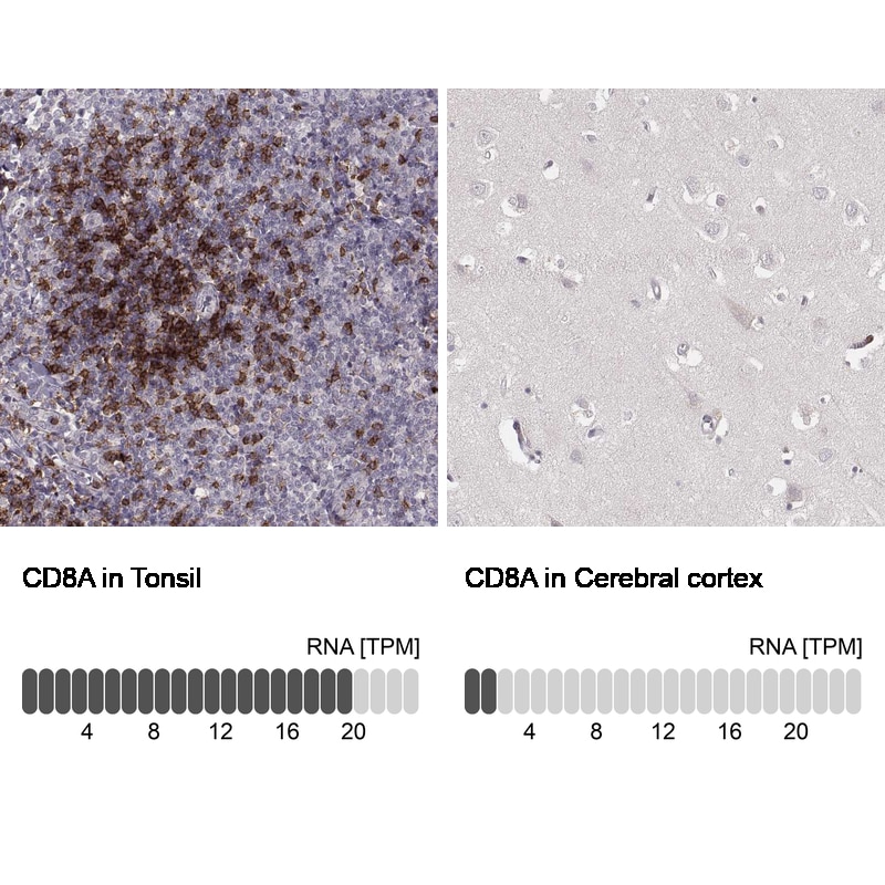 CD8 Antibody (CL1529) - Azide and BSA Free Immunohistochemistry-Paraffin: CD8 Antibody [NBP3-43780]