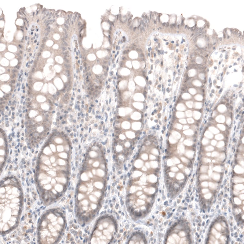 Laminin Antibody (CL2968) - Azide and BSA Free Immunohistochemistry-Paraffin: Laminin Antibody [NBP3-43781]