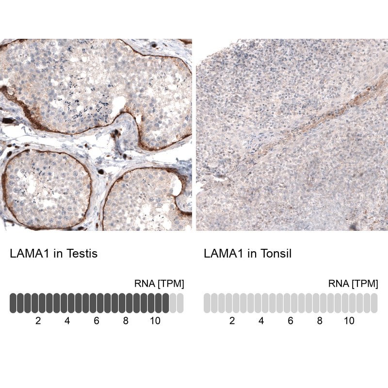 Laminin Antibody (CL2968) - Azide and BSA Free Immunohistochemistry-Paraffin: Laminin Antibody [NBP3-43781]