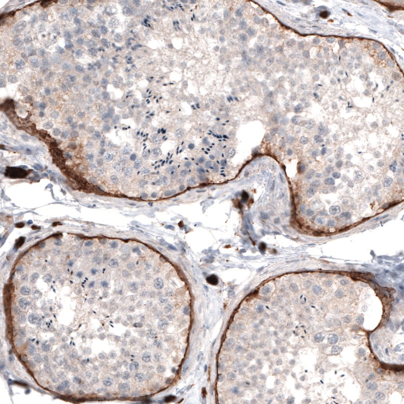 Laminin Antibody (CL2968) - Azide and BSA Free Immunohistochemistry-Paraffin: Laminin Antibody [NBP3-43781]