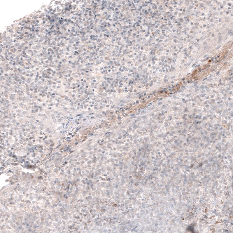 Laminin Antibody (CL2968) - Azide and BSA Free Immunohistochemistry-Paraffin: Laminin Antibody [NBP3-43781]