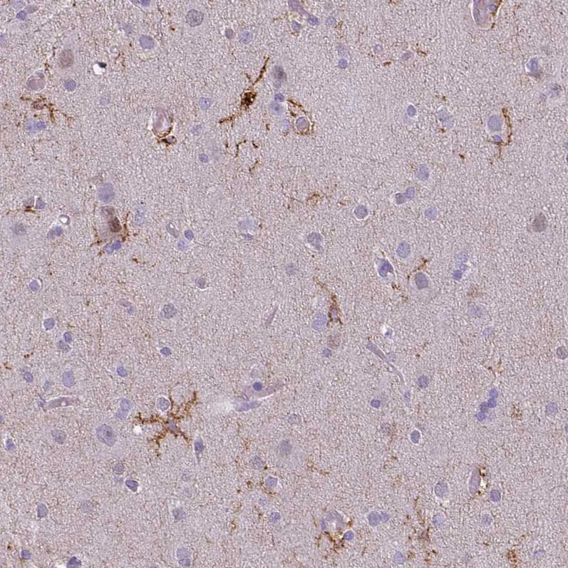 CD11b Antibody (CL1719) - Azide and BSA Free Immunohistochemistry-Paraffin: CD11b Antibody [NBP3-43784]
