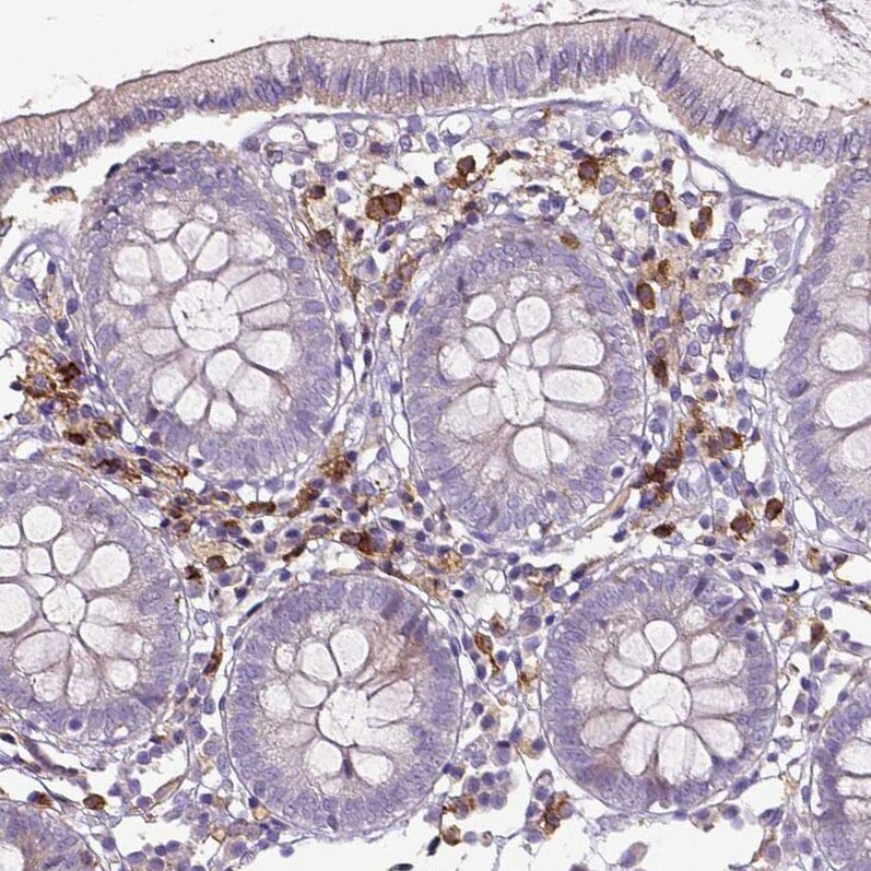 CD11b Antibody (CL1719) - Azide and BSA Free Immunohistochemistry-Paraffin: CD11b Antibody [NBP3-43784]