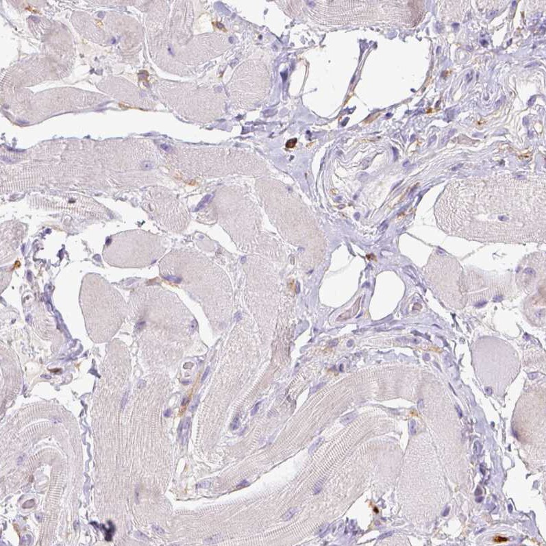 CD11b Antibody (CL1719) - Azide and BSA Free Immunohistochemistry-Paraffin: CD11b Antibody [NBP3-43784]