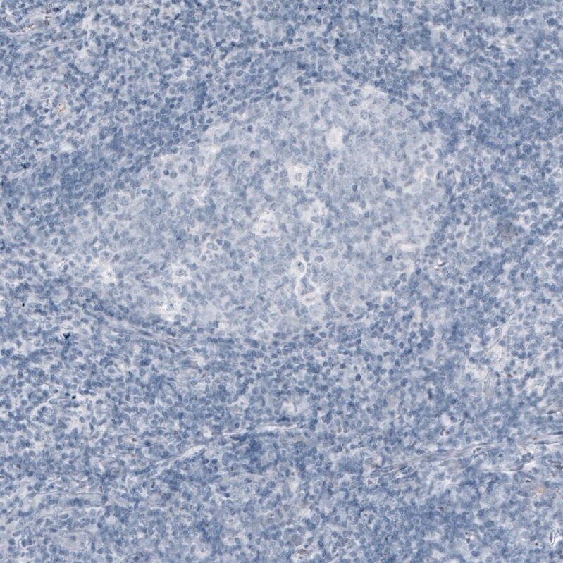 MOG Antibody (CL2858) - Azide and BSA Free Immunohistochemistry-Paraffin: MOG Antibody [NBP3-43786]