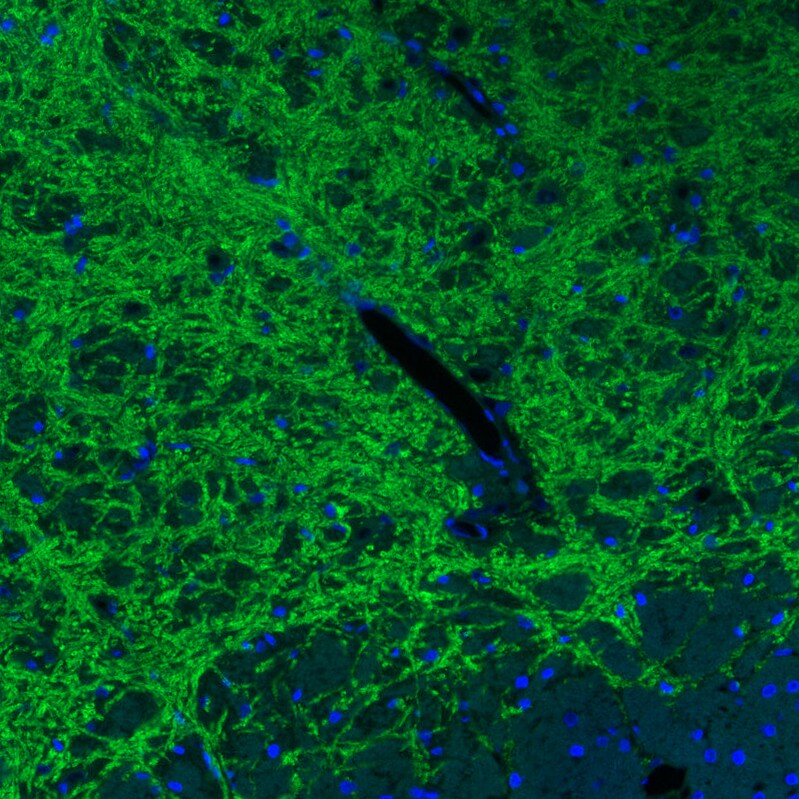 VIAAT/SLC32A1/VGAT Antibody (CL2793) - Azide and BSA Free Immunohistochemistry-Paraffin: VIAAT/SLC32A1/VGAT Antibody [NBP3-43787]