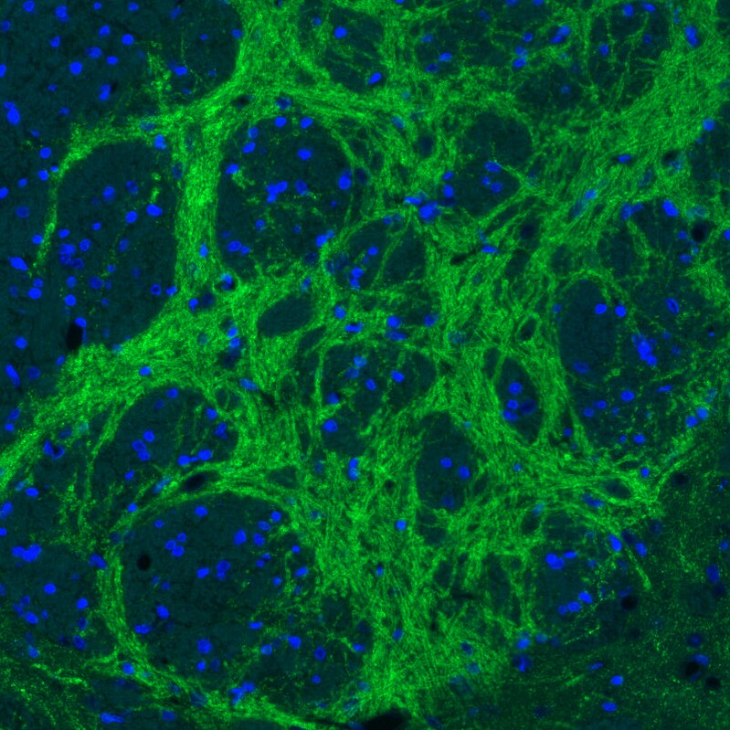 VIAAT/SLC32A1/VGAT Antibody (CL2793) - Azide and BSA Free Immunohistochemistry-Paraffin: VIAAT/SLC32A1/VGAT Antibody [NBP3-43787]
