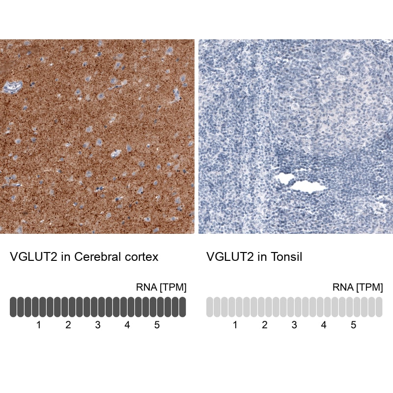 VGLUT2 Antibody (CL2952) - Azide and BSA Free Immunohistochemistry-Paraffin: VGLUT2 Antibody [NBP3-43789]