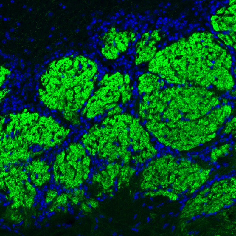 VGLUT2 Antibody (CL2952) - Azide and BSA Free Immunohistochemistry-Paraffin: VGLUT2 Antibody [NBP3-43789]