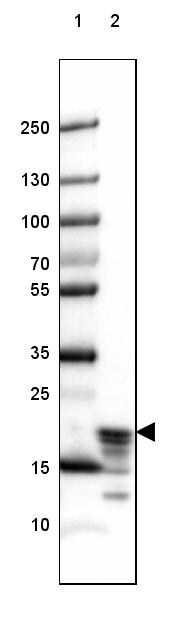 MBP Antibody (CL2819) - Azide and BSA Free Western Blot: MBP Antibody [NBP3-43790]