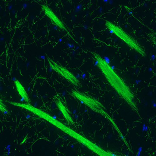 MBP Antibody (CL2819) - Azide and BSA Free Immunohistochemistry-Paraffin: MBP Antibody [NBP3-43790]