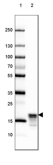 MBP Antibody (CL2827) - Azide and BSA Free Western Blot: MBP Antibody [NBP3-43792]