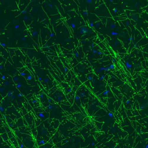 MBP Antibody (CL2827) - Azide and BSA Free Immunohistochemistry-Paraffin: MBP Antibody [NBP3-43792]