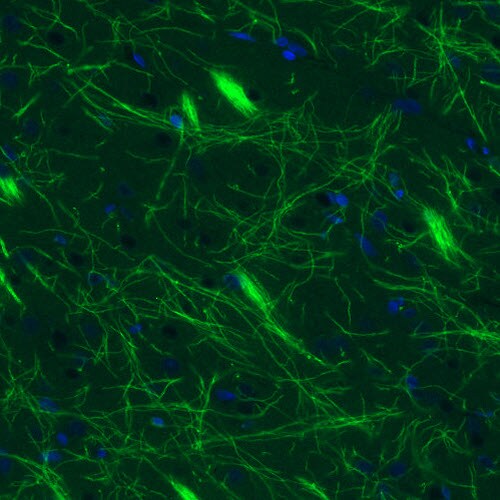MBP Antibody (CL2827) - Azide and BSA Free Immunohistochemistry-Paraffin: MBP Antibody [NBP3-43792]