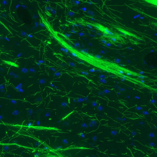 MBP Antibody (CL2827) - Azide and BSA Free Immunohistochemistry-Paraffin: MBP Antibody [NBP3-43792]