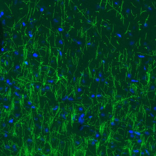 MBP Antibody (CL2827) - Azide and BSA Free Immunohistochemistry-Paraffin: MBP Antibody [NBP3-43792]
