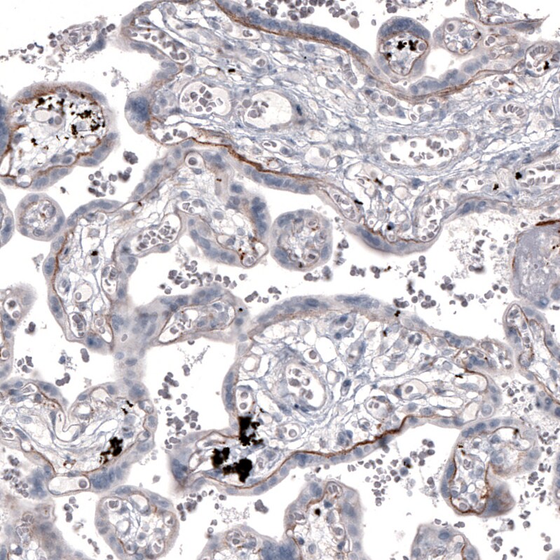 Laminin alpha 2 Antibody (CL3450) - Azide and BSA Free Immunohistochemistry-Paraffin: Laminin alpha 2 Antibody [NBP3-43794]