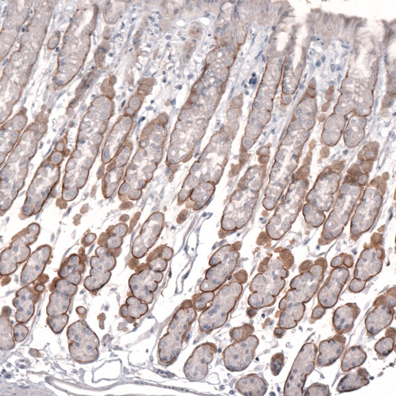 Laminin alpha 2 Antibody (CL3450) - Azide and BSA Free Immunohistochemistry-Paraffin: Laminin alpha 2 Antibody [NBP3-43794]