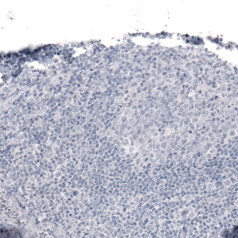 Laminin alpha 2 Antibody (CL3450) - Azide and BSA Free Immunohistochemistry-Paraffin: Laminin alpha 2 Antibody [NBP3-43794]