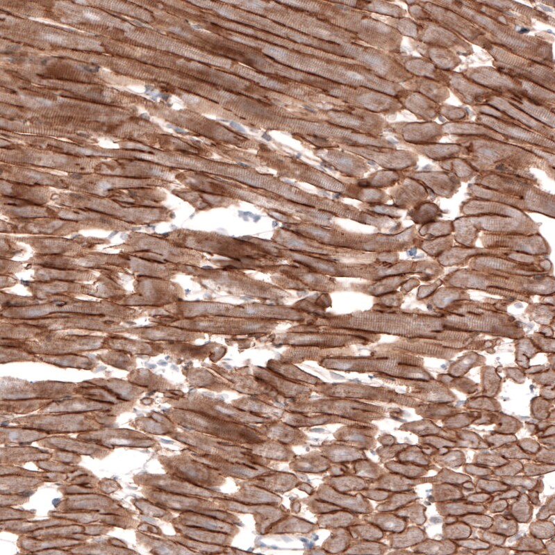 Laminin alpha 2 Antibody (CL3450) - Azide and BSA Free Immunohistochemistry-Paraffin: Laminin alpha 2 Antibody [NBP3-43794]
