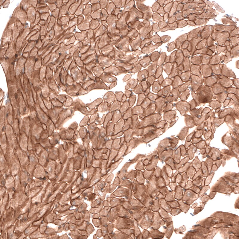 Laminin alpha 2 Antibody (CL3450) - Azide and BSA Free Immunohistochemistry-Paraffin: Laminin alpha 2 Antibody [NBP3-43794]
