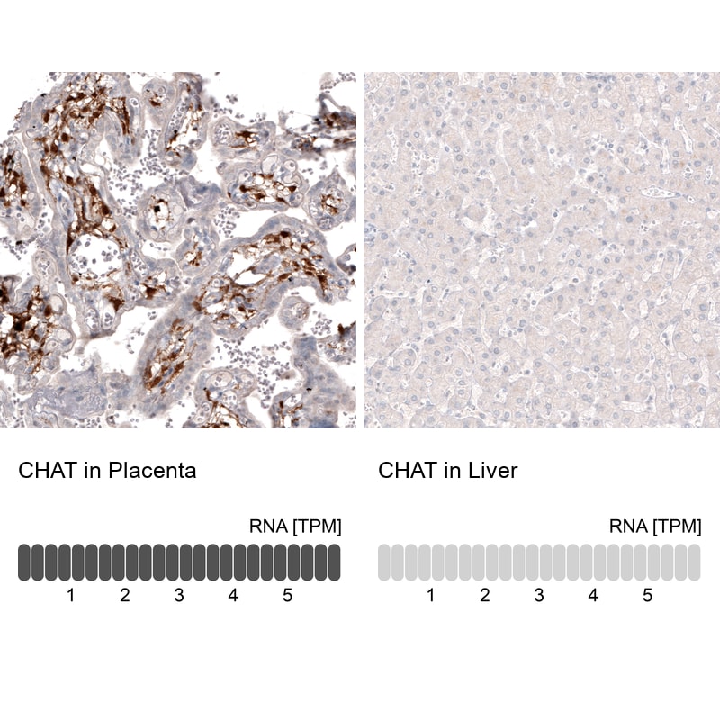 Choline Acetyltransferase/ChAT Antibody (CL3173) - Azide and BSA Free Immunohistochemistry-Paraffin: Choline Acetyltransferase/ChAT Antibody [NBP3-43796]