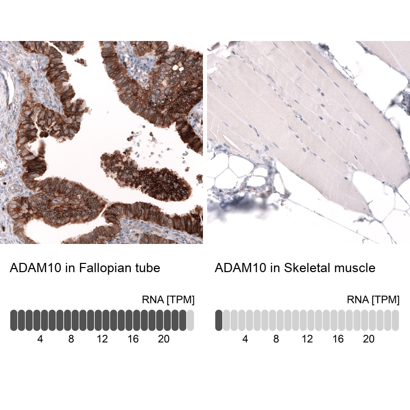 ADAM10 Antibody (CL13809) - Azide and BSA Free Immunohistochemistry-Paraffin: ADAM10 Antibody [NBP3-43797]