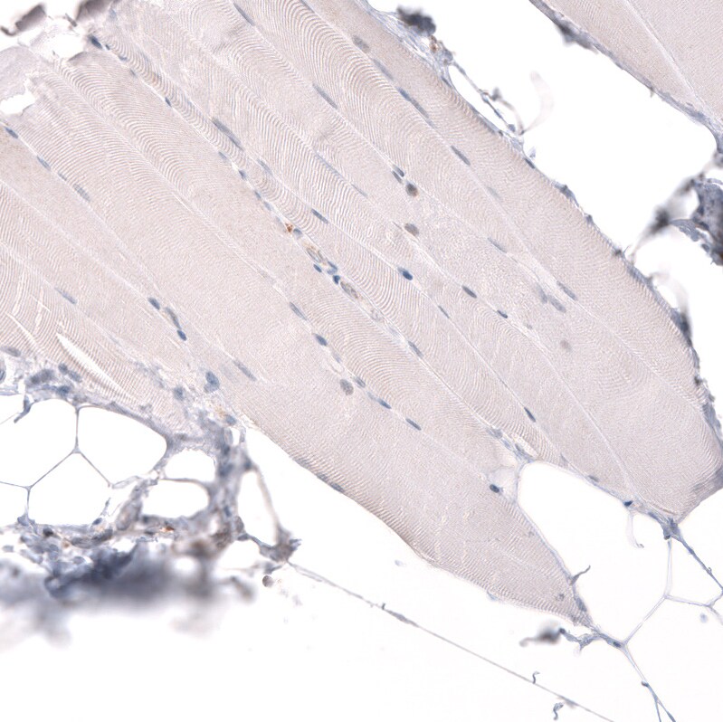 ADAM10 Antibody (CL13809) - Azide and BSA Free Immunohistochemistry-Paraffin: ADAM10 Antibody [NBP3-43797]
