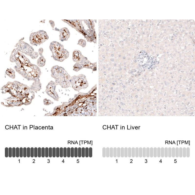 Choline Acetyltransferase/ChAT Antibody (CL3169) - Azide and BSA Free Immunohistochemistry-Paraffin: Choline Acetyltransferase/ChAT Antibody [NBP3-43798]